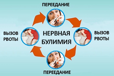 Лечение булимии в Купино